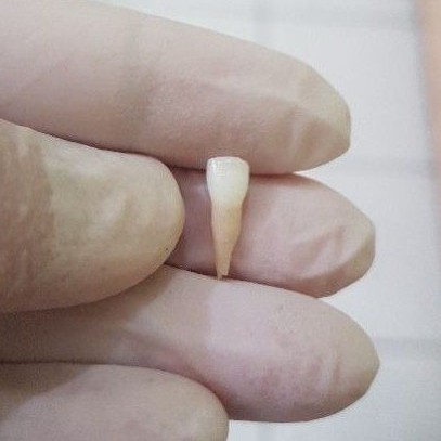 [SULUNG/SUSU] GIGI ASLI MANUSIA SERI / INCISIVUS SUSU / SULUNG / ANAK UNTUK PRAKTIKUM
