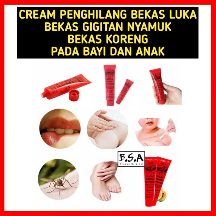 Mantap Cream Penghilang Bekas Luka Bekas Gigitan Nyamuk Pada Bayi Dan Anak Hemat