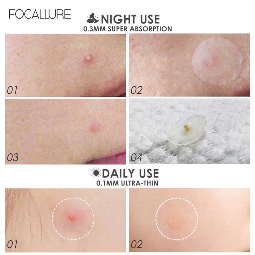 ❤ BELIA ❤ FOCALLURE Acne Pimple Patch Day Invisible Acne FA186 | Night 2x Repair | 24 Patch | Solusi Jerawat | BPOM