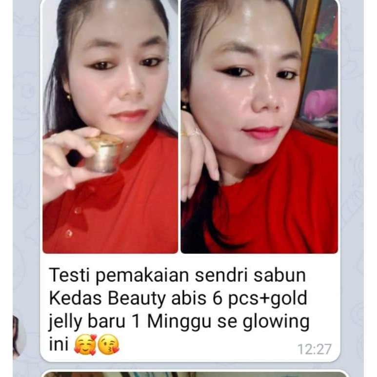 READY GOLD JELLY KEDAS BEAUTY
