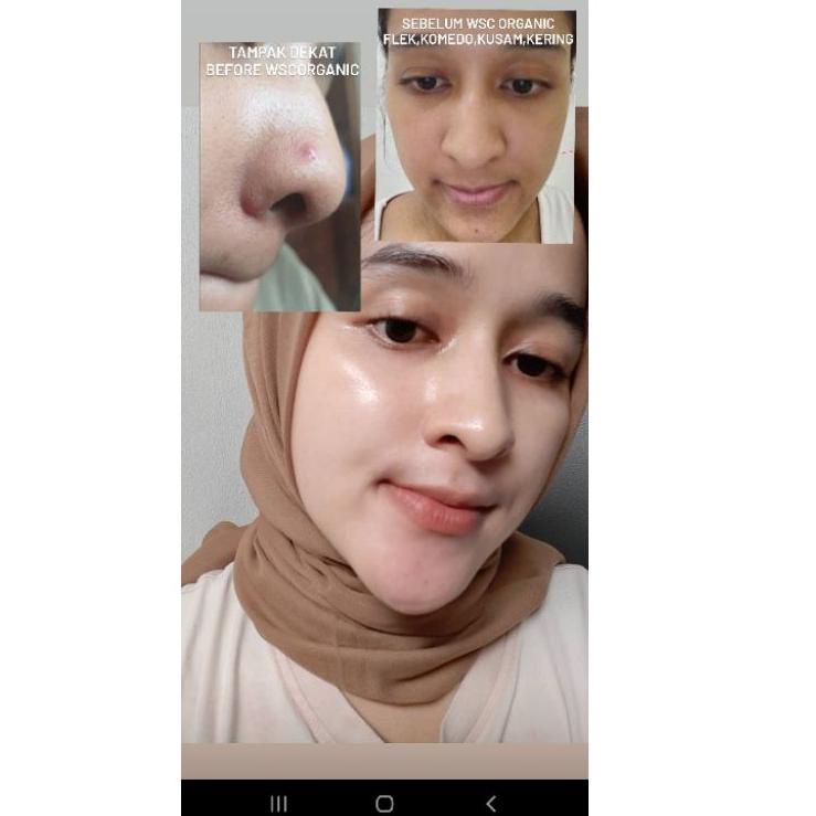 Seller Paket Mini VIRAL RETINOL WSC Organic cream wajah flek jerawat skincare glowing series viral 7