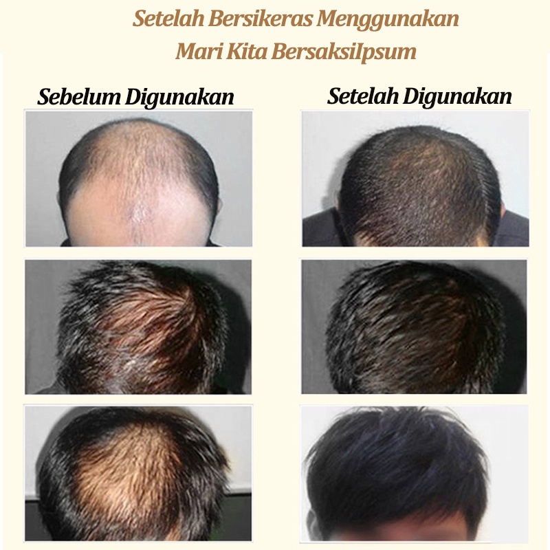 shampo rambut rontok shampo anti rontok Sampo jahe 400ml Anti-hair loss anti ketombe Kontrol Minyak pertumbuhan rambut