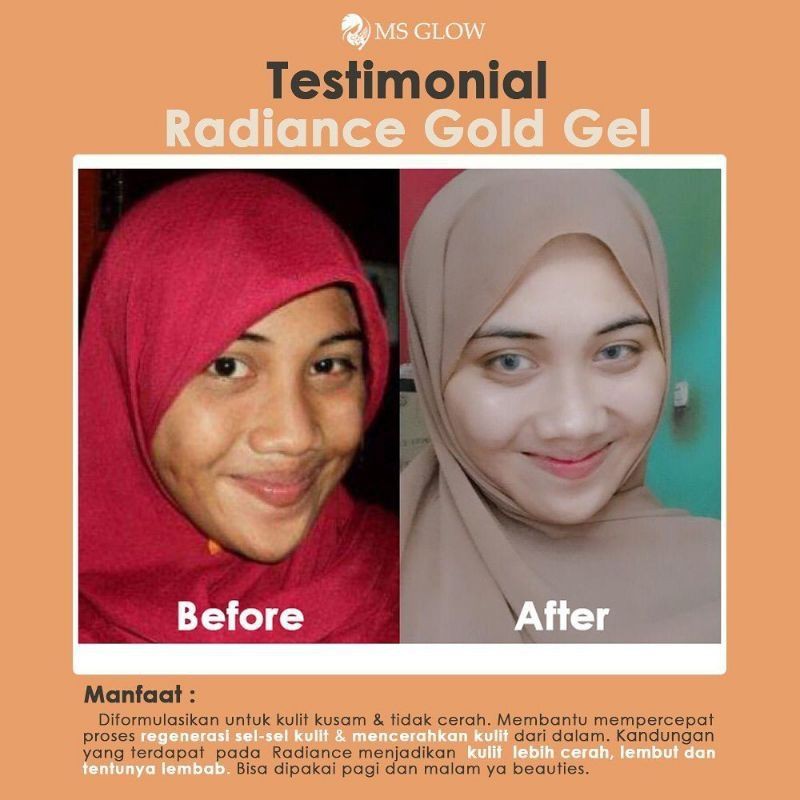 RADIANCE GOLD GEL MSGLOW