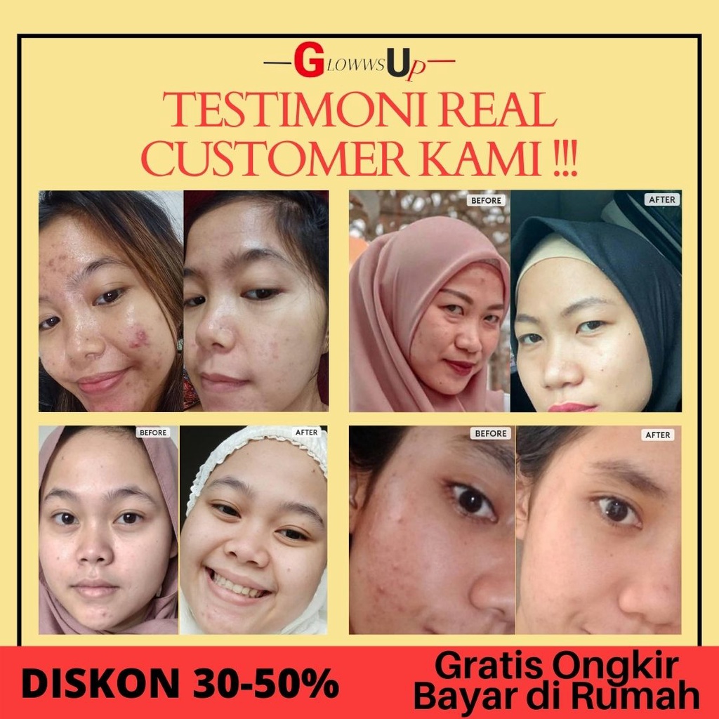 RETINOL SERUM SOMETHINC 1% PENGHILIANG KERUTAN WAJAH PURE RETINOL + SQUALANE PERAWATAN WAJAH