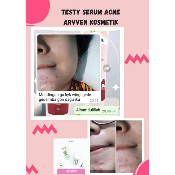 SERUM WAJAH ARVVEN / SNOW WHITE SERUM / ACNE SERUM / MULBERRY SERUM