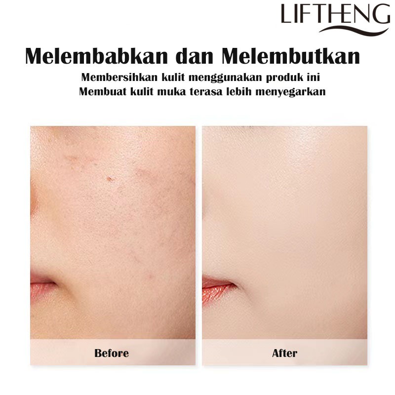 LIFTHENG Hyaluronic Acid Saccharomyce Aloevera Gel pelembab wajah efektif