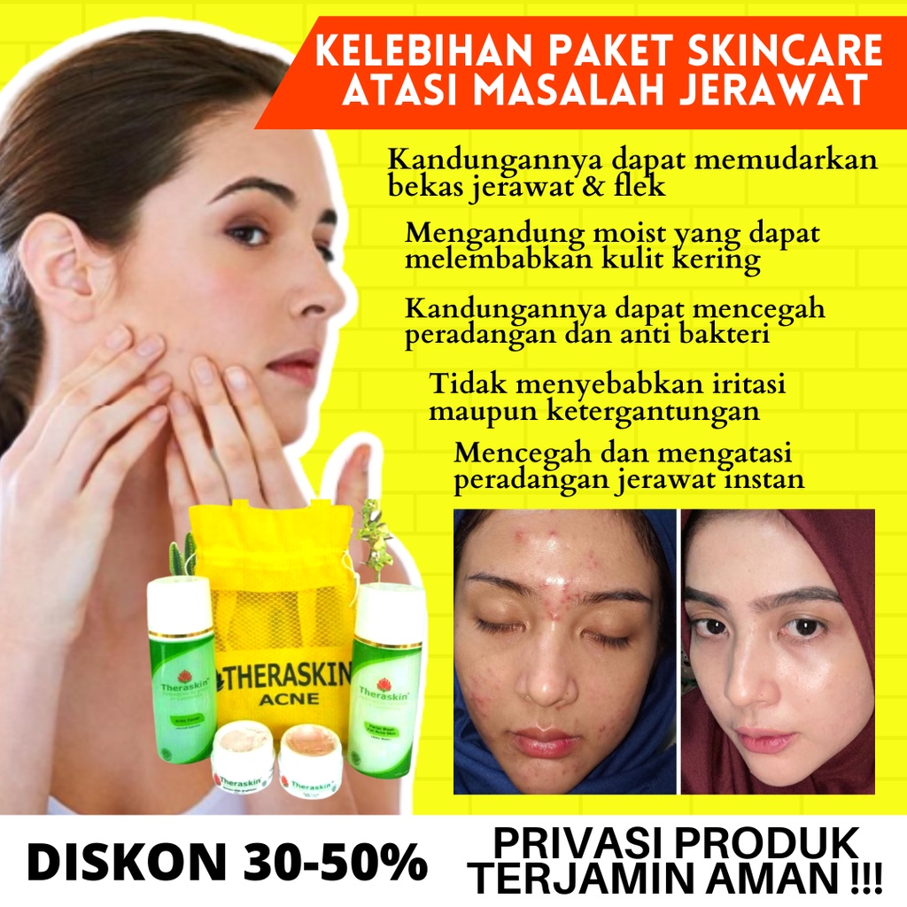 THERASKIN PAKET ACNE PENGHILANG JERAWAT PENCERAH WAJAH PAKET THERASKIN  ACNE PERAWATAN WAJAH BERJERAWAT ORIGINAL BPOM