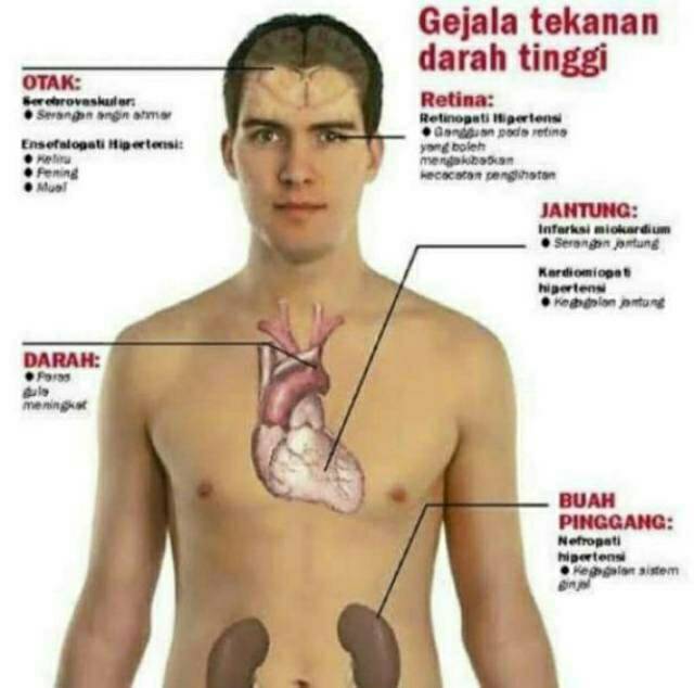 RECARDIO Asli Obat Recardio original obat herbal hipertensi jantung struk terbukti hasilnya-1