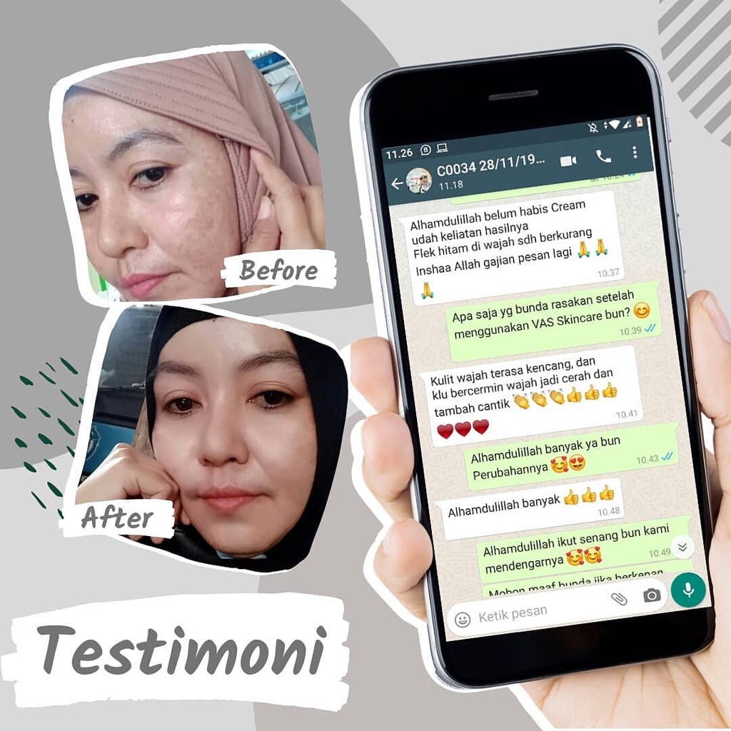 (GRATIS ONGKIR) Paket Premium VAS Skincare asli krim cream serum penghilang flek hitam membandel di wajah penghilang jerawat dan bekas jerawat pemutih glowing ampuh permanen bpom alami original