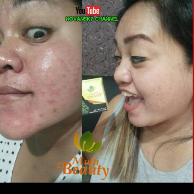 Multi Beauty Soap Original