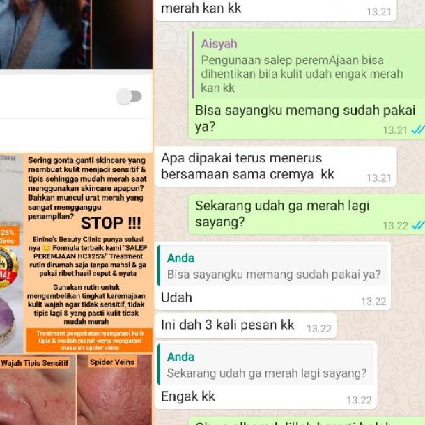 ← Peremajaan 125% High Class (Cream Kulit Tipis Mudah Merah & Spider Veins) ➻