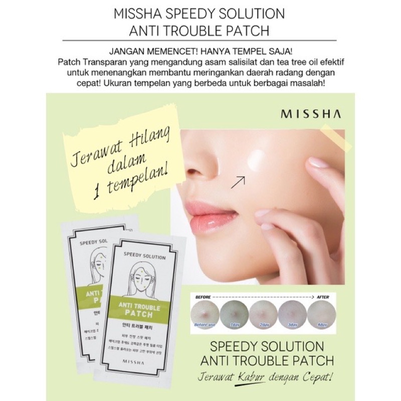 [BPOM] MISSHA Speedy Solution Anti Trouble (Acne) ACNE Patch (Stiker Jerawat) Original Korea