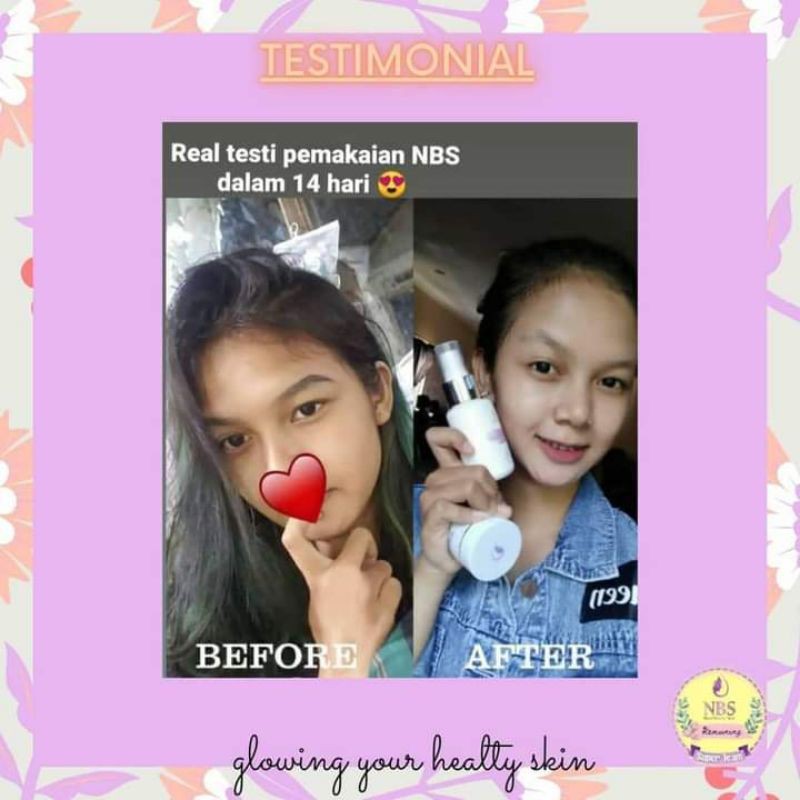 NBS skincare BPOM aman dan halal