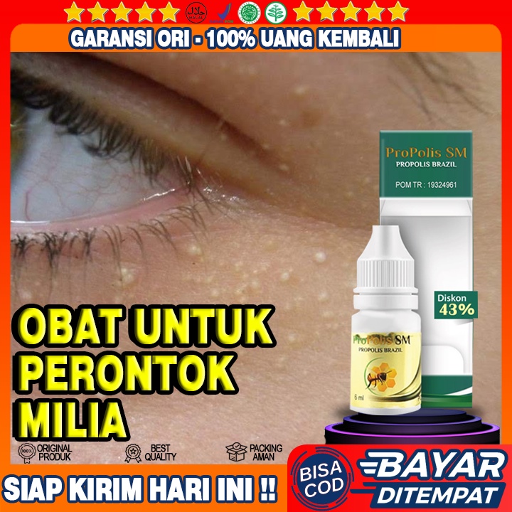 Obat Perontok Milia, Obat Penghilang Milia Mata, Obat Tetes Milia Wajah