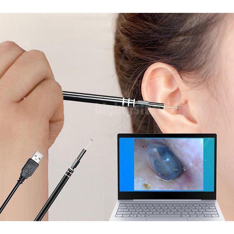 (Original) Korek Pembersih Kuping Telinga Kamera HD Visual USB Port Laptop Smartphone Sendok