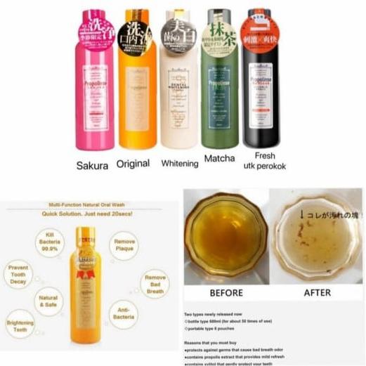 Propolinse Mouth Wash / Obat Kumur 600 ml Original Jepang Obat Kumur