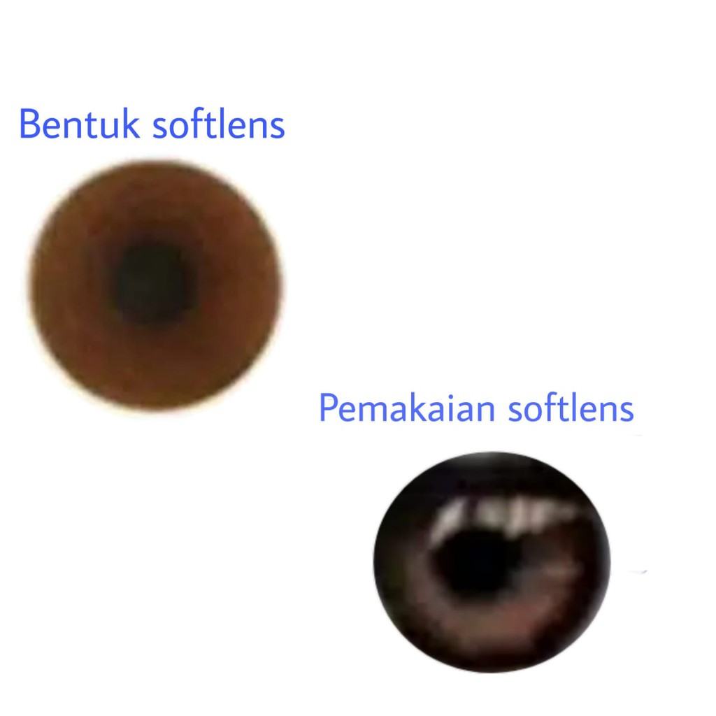 Softlens Untuk Mata Cacat