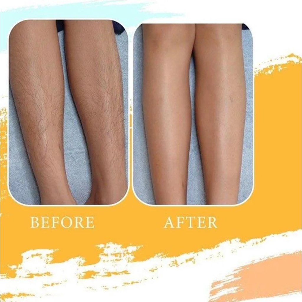 SHINE STAR - Sugar Wax Waxing Kit Penghilang Bulu Rambut Bulu Ketiak Bulu Kaki Tangan Permanen RANDOM