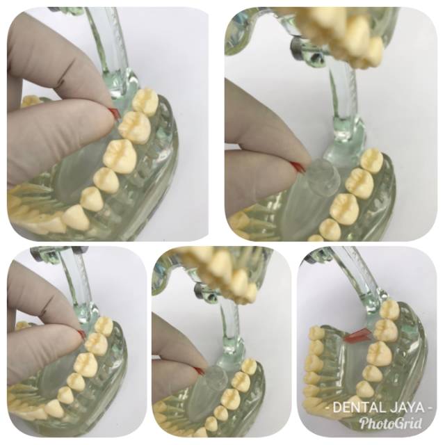 Matrix Transparent Contoured // Transparent Matrix // Matrix Kelas 2