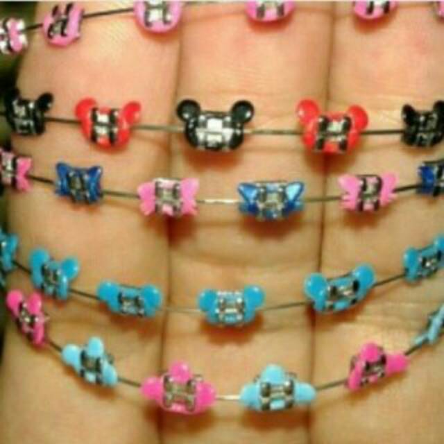 Behel lepas pasang