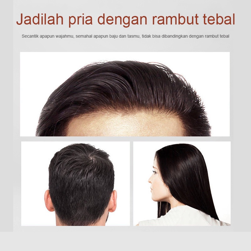 【O'RANNLE】Ekstrak Jahe Murni Mengentalkan Rambut Bayi dan Dewasa, Jenggot, Kumis, Jenggot, Alis Vitamin jahe rambut  Vitamin rambut Pertumbuhan rambut  Musuh botak   Cairan penumbuh rambut  Cairan pertumbuhan