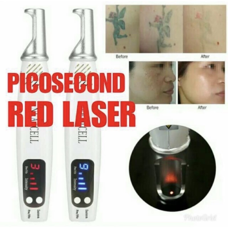 LASER PICOSECOND NEATCELL