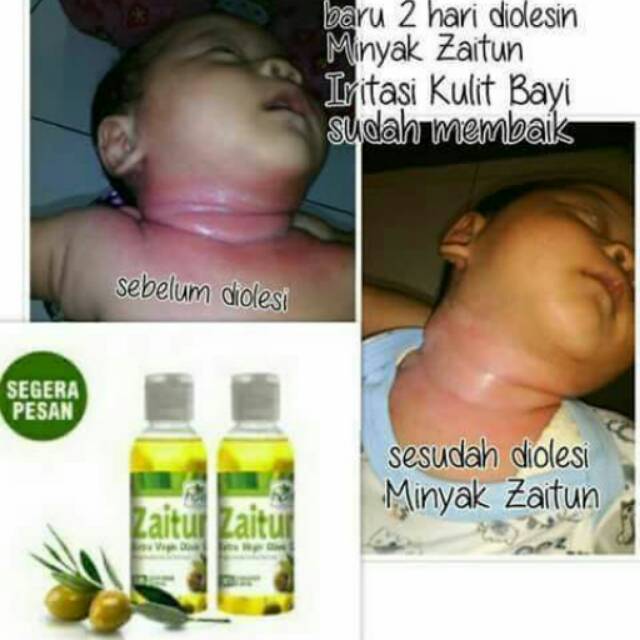 Minyak zaitun HNI HPAI