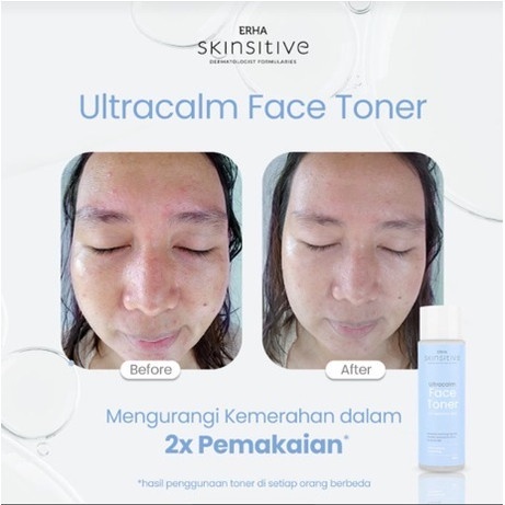 ERHA Toner Wajah Skinsitive Ultracalm Face Toner -  Kulit Sensitif