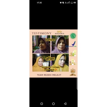 Anzora skincare BPOM