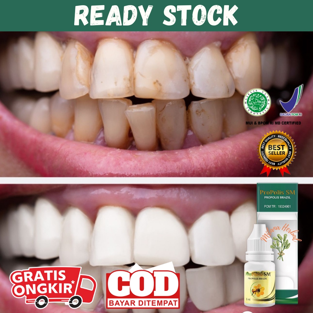 Obat Pemutih Gigi Kuning, Obat Sakit Gigi Berlubang, Obat Sakit Gigi Nyut Nyutan, Obat Nyeri Gigi An
