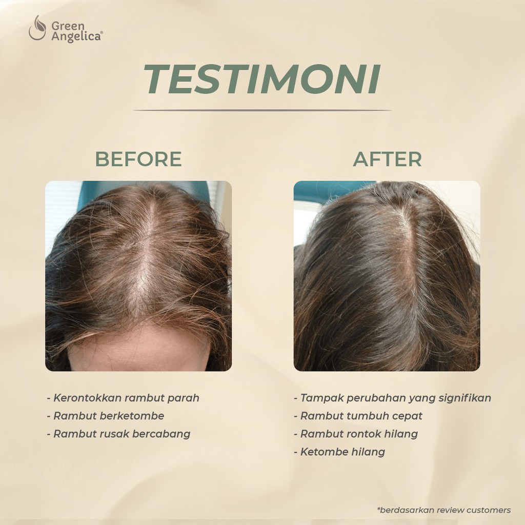 Green Angelica Hair Nutrition Shampoo Rambut Rontok Lepek dan Berketombe BPOM 100 ml-8