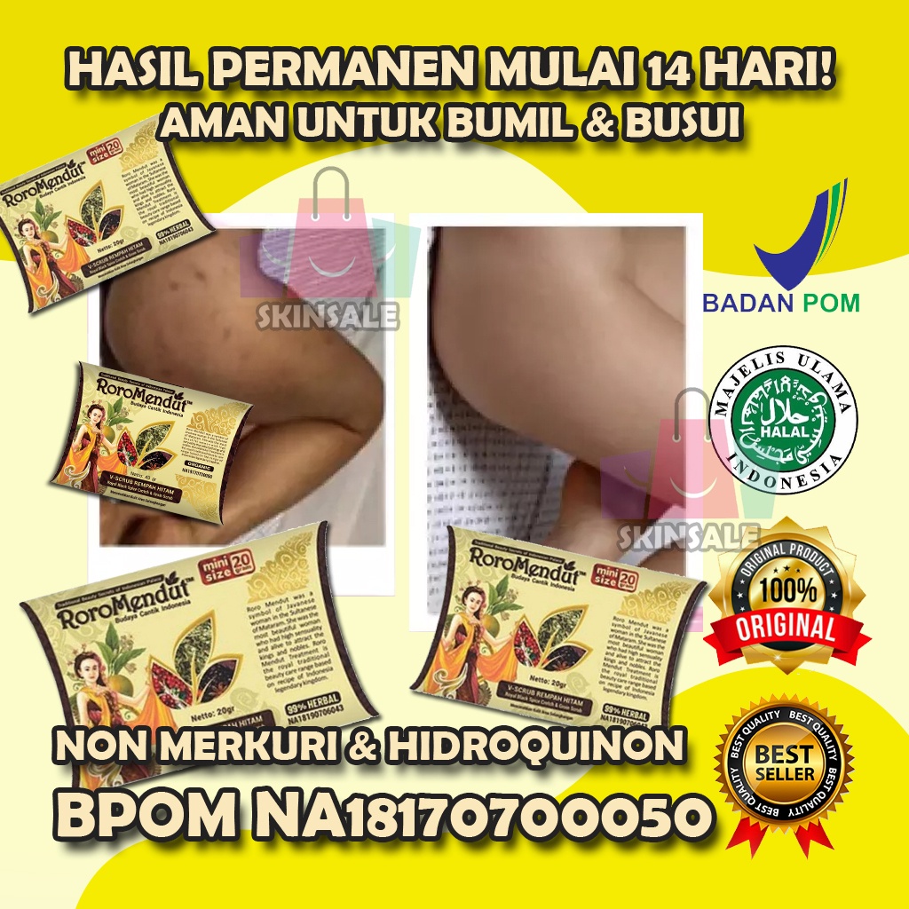 V SCRUB PEMUTIH SELANGKAGAN OBAT SELANGKANGAN GATAL DAN HITAM PEMUTIH SELANGKANGAN DAN BOKONG PEMUTI