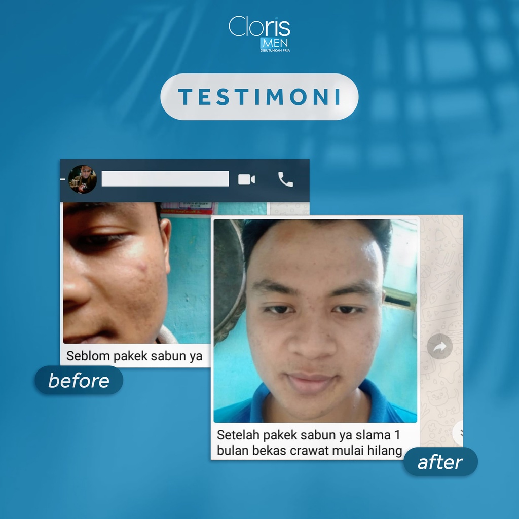 Cloris Men Soap - Sabun Cuci Muka Pembersih Wajah Pria / Facial Face Wash Acne For Men