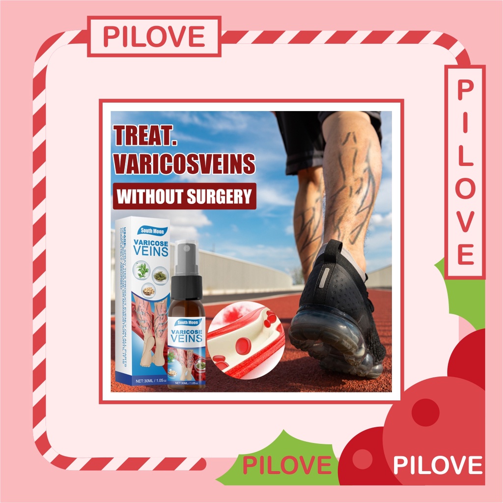 PILOVE - Salep Krim Cream Obat Penyembuh dan Penghilang Varises Parises Angitis Salep Flebitis di Kaki dan Betis Tangan Cream Krim Varises Hasil Paling Ampuh Original Hasil Permanen