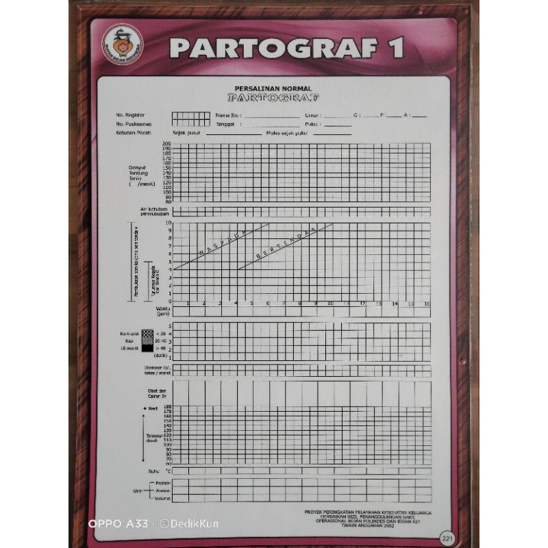 (219) POSTER PARTOGRAF 1