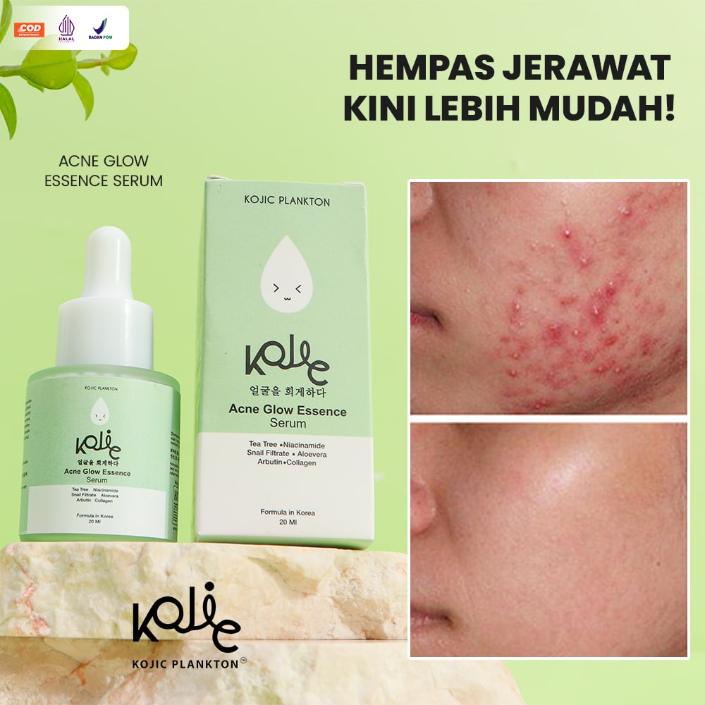 Kojic Acne Glow Essence Serum