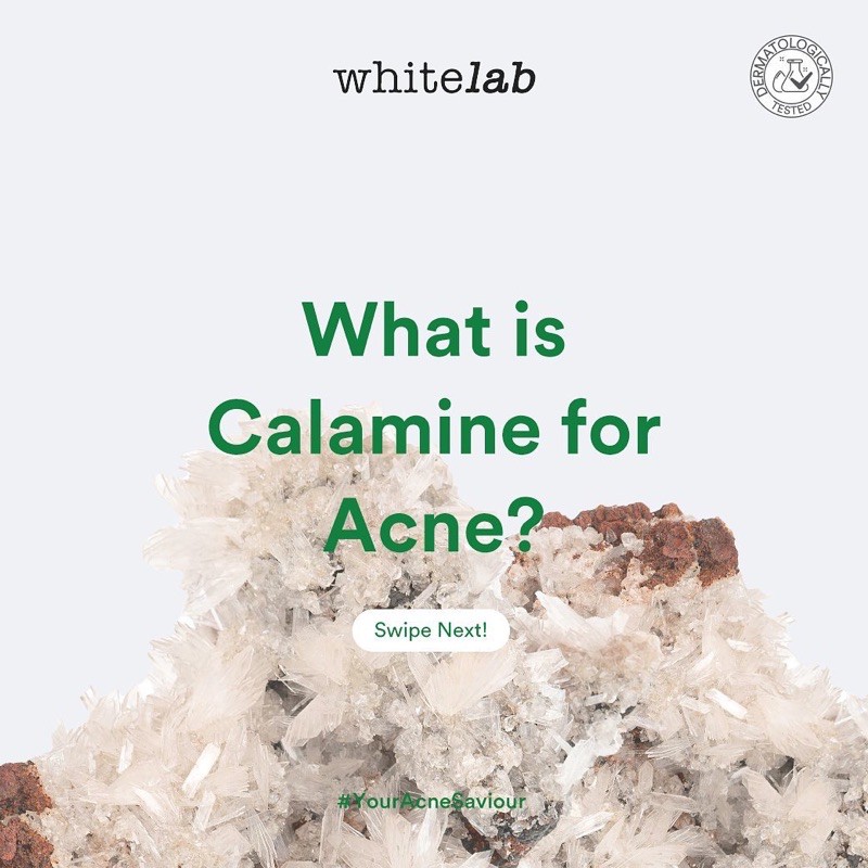 WHITELAB Acne Cream Indonesia / Facial Wash Hydrating Essence Toner Serum Ampoule Day Night Underarm Eye Cream Sunscreen Clay Mask Masker Gel Body Soap / Face Brightening Mugwort Heartleaf Niacinamide Peeling Calming Paket Wajah Lengkap Set Sabun Pelembab