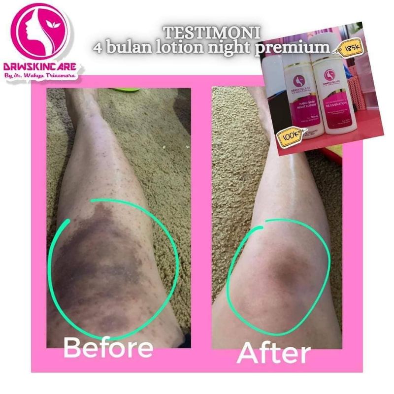 DRW Skincare HB PEMUTIH AMPUH Lation Night Rejuvanation Licorice Day Lation Premium Foundation Lation Bumil Busui Aman by dr. Wahyu Triasmara
