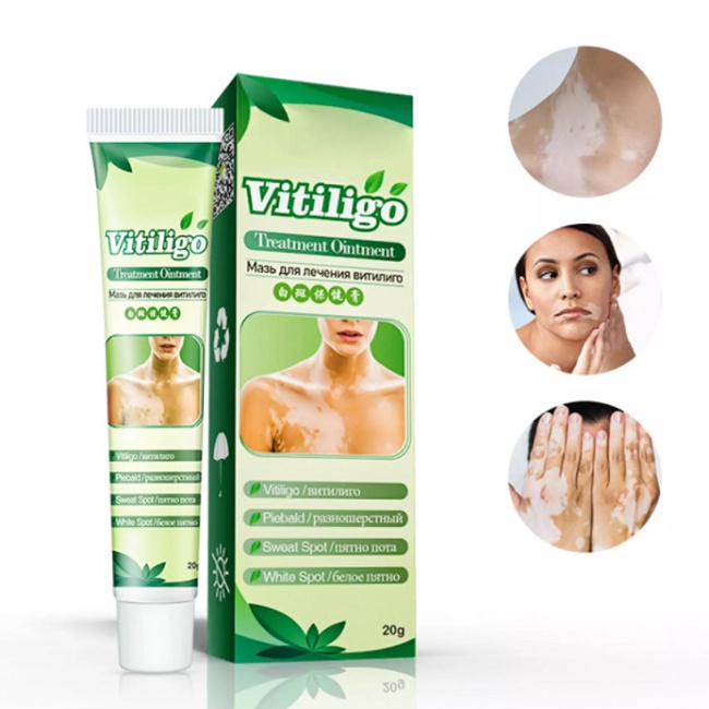 Cream Penghilang Vitiligo Salep Vitiligo Bintik Putih