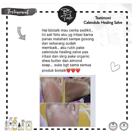 Bio talk BPOM Calendula Healing Salve for eczema and dry skin | No Steroid salep eksim