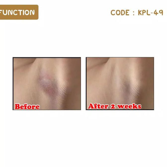 {ORI] Krim Pemutih Ketiak Selangkangan Lipatan Siku Lutut Ampuh 14 Hari | SHIN KHURIM KETIAK