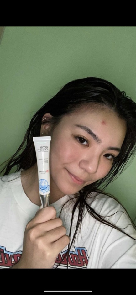 DR.SCHATZ - Dr Schatz ACNE CREAM - Obat Jerawat - Missflolaks