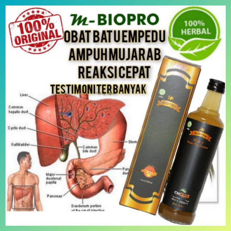 Obat Batu Empedu l Obat Batu Empedu Tanpa Operasi M Biopro 380 ml Terbukti Ampuh Reaksi Cepat