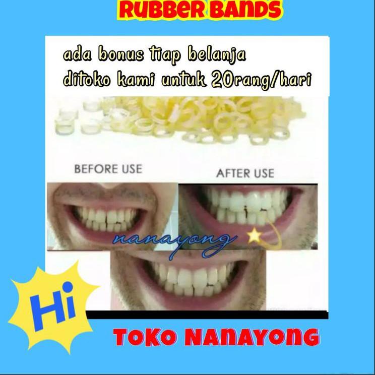 Rubber bands#Karet gigi elastis#merapatkan gigi renggang 8NFS