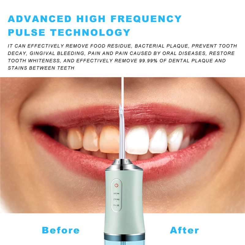 Oral Irrigator Flushing Portable USB Rechargeable Oral Care Dental Scaler Teeth Multifunctional Water Spray