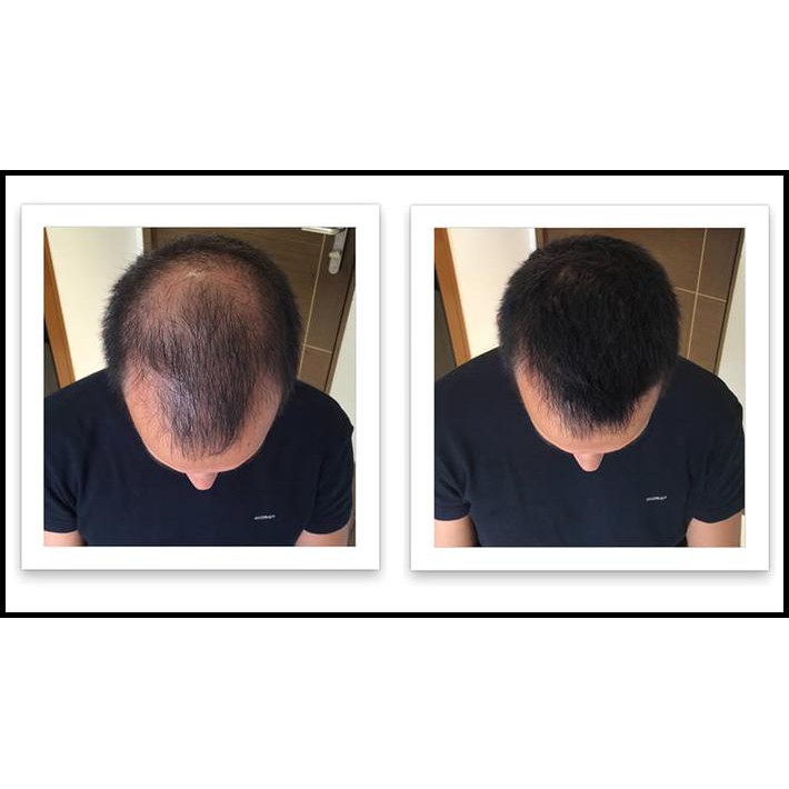 Produk Terlaris - Sample Bebold Hair Fiber 25 Gr Penebal Rambut Botak Caboki Dexe Ori