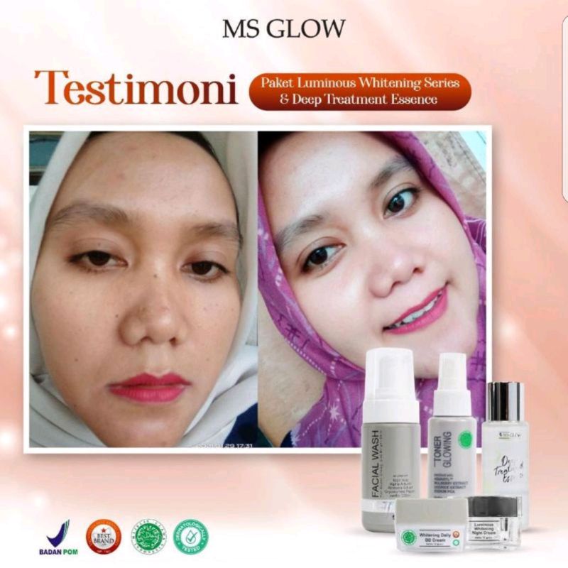 Paket Luminous + Deep Treatment Essence MS GLOW