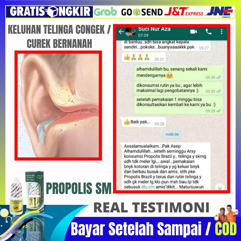 Propolis Sm Brazil Obat Tetes Telinga Tersumbat Telinga Budeg Sebelah Telinga Berair Congek Shopee Indonesia