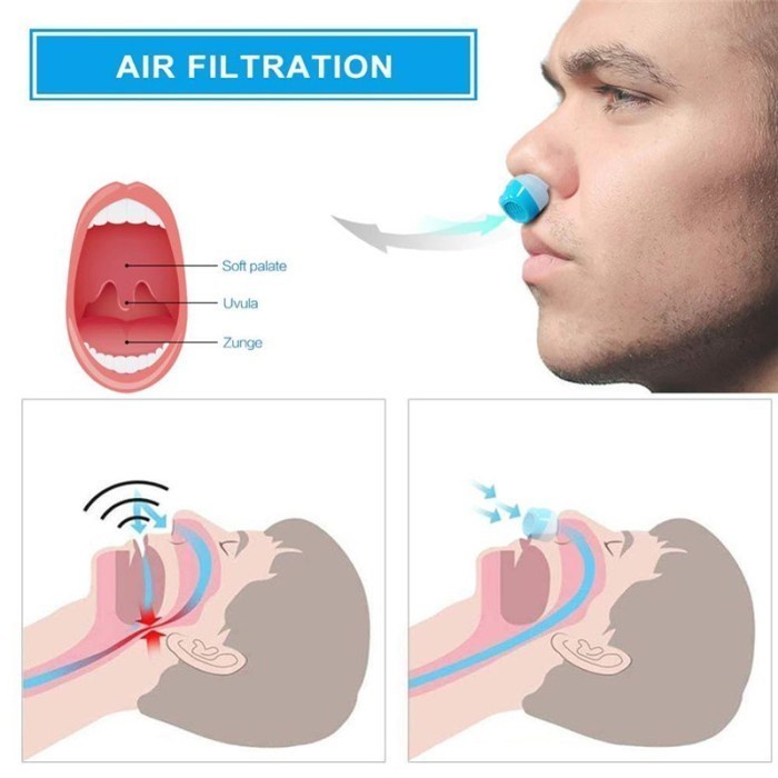 Anti Ngorok Snooring Solution