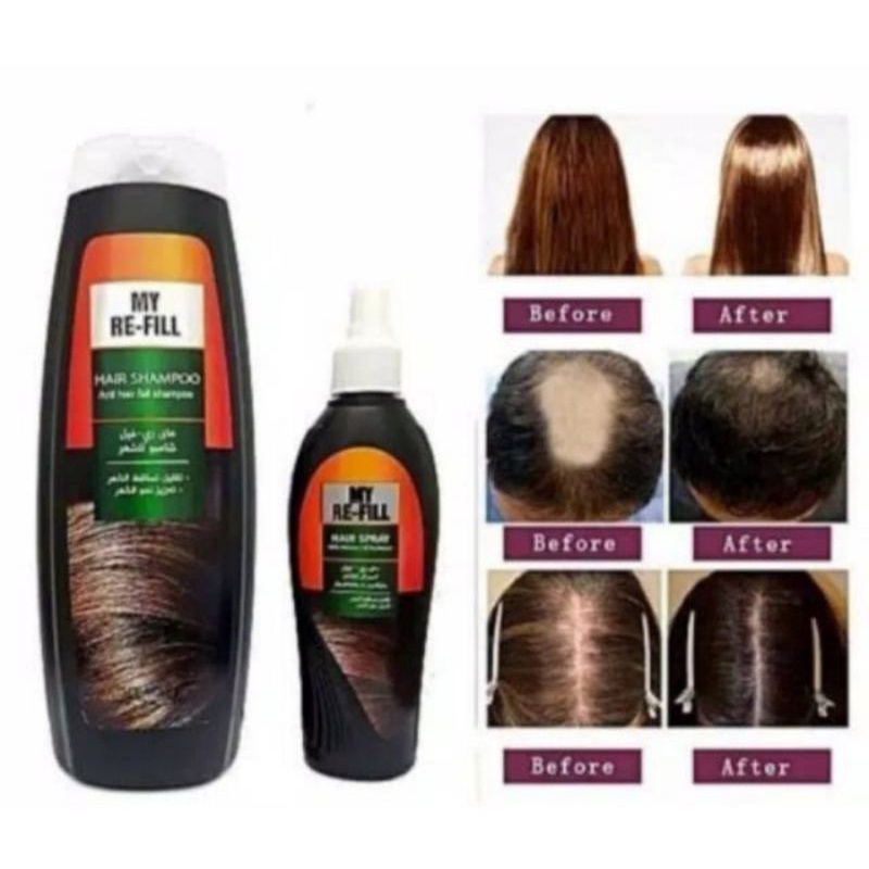 shampoo anti rontok refill my way